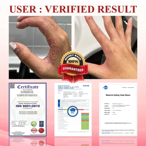 𝗖𝗮𝘀𝗲𝗹𝗮𝘀𝘁® 𝗚𝗹𝘂𝗰𝗼𝘀𝗲𝗚𝘂𝗮𝗿𝗱 𝗦𝗸𝗶𝗻 𝗥𝗲𝘀𝗰𝘂𝗲 𝗖𝗿𝗲𝗮𝗺 - Image 4